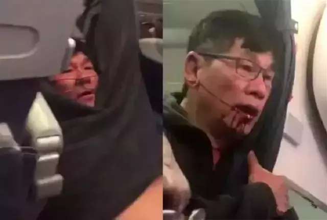 David Dao已经和美联航达成了庭外和解3.jpg
