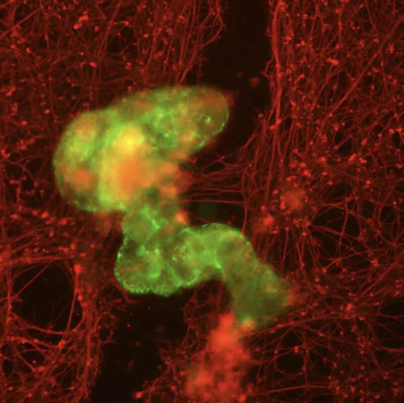 机器人（绿色部分）在穿过受损神经细胞（红色部分）时，能促进神经细胞受损区域生长 ...